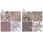 Anti-SUCLG2 Antibody