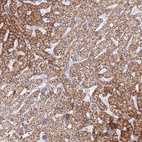 Immunohistochemical staining of human liver shows strong granular cytoplasmic positivity in hepatocytes.