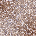 Immunohistochemical staining of human liver shows strong granular cytoplasmic positivity in hepatocytes.
