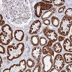 Immunohistochemical staining of human kidney shows strong granular cytoplasmic positivity in cells in tubules.