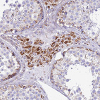 Immunohistochemical staining of human testis shows moderate granular cytoplasmic positivity in Leydig cells.