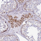 Immunohistochemical staining of human testis shows moderate granular cytoplasmic positivity in Leydig cells.