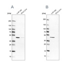 Western blot analysis using Anti-SUCLG2 antibody HPA046705 (A) shows similar pattern to independent antibody HPA051998 (B).