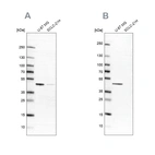 Western blot analysis using Anti-SUCLG2 antibody HPA046705 (A) shows similar pattern to independent antibody HPA051998 (B).