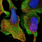 Immunofluorescent staining of human cell line U-2 OS shows localization to nucleoplasm, plasma membrane & cytosol.