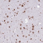 Anti-VARS Antibody