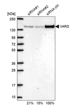 Western blot analysis in U2OS cells transfected with control siRNA, target specific siRNA probe #1 and #2, using Anti-VARS antibody. Remaining relative intensity is presented.