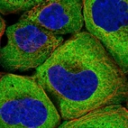 Immunofluorescent staining of human cell line A-431 shows localization to cytosol.