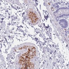 Anti-OR5D16 Antibody