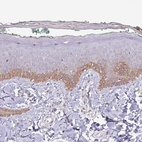 Immunohistochemical staining of human skin shows moderate granular cytoplasmic positivity in squamous epithelial cells.