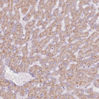 Immunohistochemical staining of human liver shows moderate granular cytoplasmic positivity in hepatocytes.
