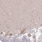 Immunohistochemical staining of human cerebellum shows weak granular cytoplasmic positivity in Purkinje cells.
