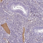 Immunohistochemical staining of human endometrium shows moderate positivity in plasma.