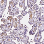 Immunohistochemical staining of human placenta shows moderate positivity in plasma.