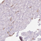 Immunohistochemical staining of human liver shows weak to moderate cytoplasmic positivity in hepatocytes.