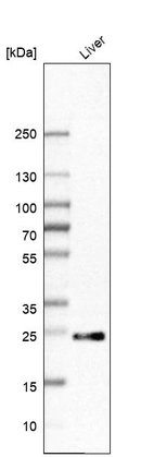 Western blot analysis in human liver tissue.