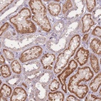 Anti-UCMA Antibody