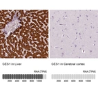 Anti-CES1 Antibody