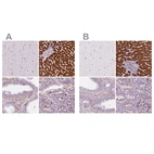 Immunohistochemical staining of human cerebral cortex, liver, prostate and upper gastrointestinal using Anti-CES1 antibody HPA046717 (A) shows similar protein distribution across tissues to independent antibody HPA012023 (B).