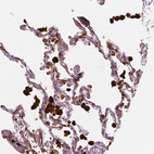Immunohistochemical staining of human lung shows strong cytoplasmic positivity in macrophages.