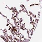 Immunohistochemical staining of human lung shows strong cytoplasmic positivity in macrophages.