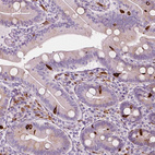 Immunohistochemical staining of human small intestine shows strong cytoplasmic positivity in enteroendocrine cells.