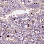 Immunohistochemical staining of human small intestine shows strong cytoplasmic positivity in enteroendocrine cells.