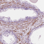 Immunohistochemical staining of human prostate shows moderate cytoplasmic positivity in smooth muscle cells.