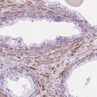 Immunohistochemical staining of human prostate shows moderate cytoplasmic positivity in smooth muscle cells.