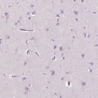 Immunohistochemical staining of human cerebral cortex shows no cytoplasmic positivity in neuronal cells as expected.
