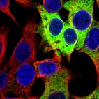 Immunofluorescent staining of human cell line Hep G2 shows localization to endoplasmic reticulum.