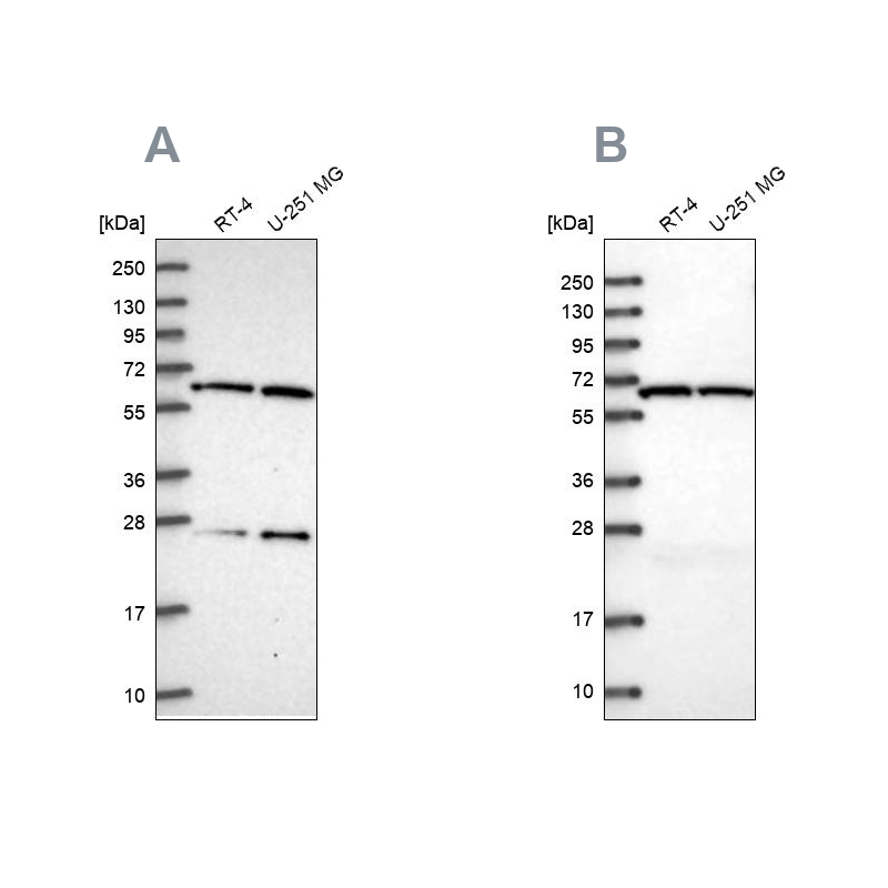 Anti-ACAD9 Antibody