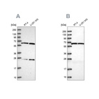 Anti-ACAD9 Antibody