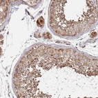 Anti-ABCB6 Antibody