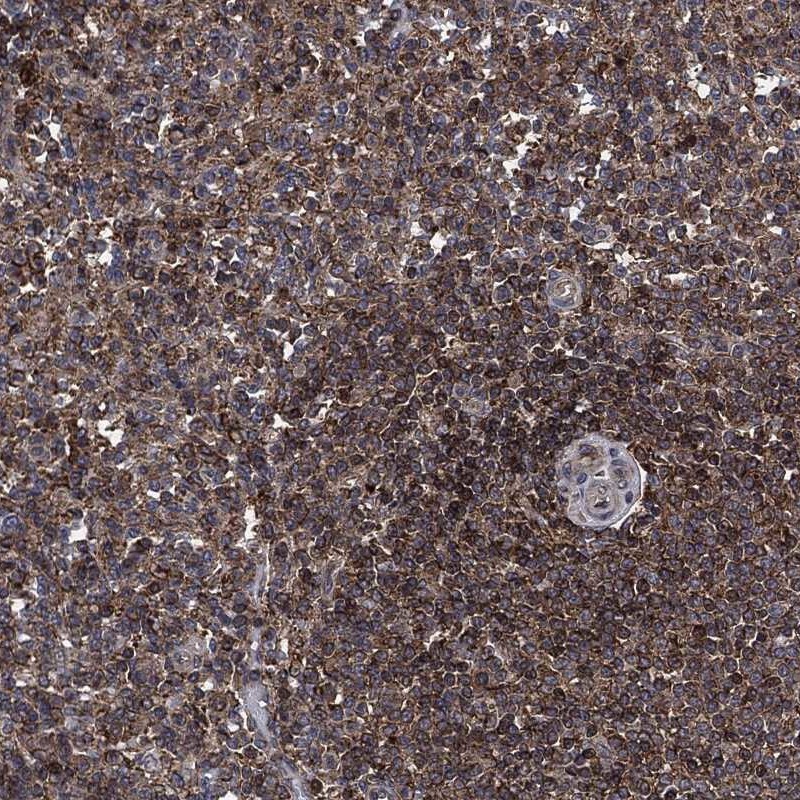 Anti-UBR1 Antibody