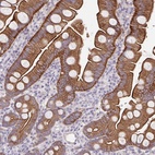 Anti-PTPN3 Antibody