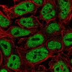 Immunofluorescent staining of human cell line CACO-2 shows localization to nucleoplasm.