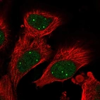 Immunofluorescent staining of human cell line U-251 MG shows localization to nuclear bodies.