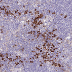 Immunohistochemical staining of human lymph node shows strong cytoplasmic positivity in non-germinal center cells.