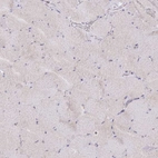 Immunohistochemical staining of human skeletal muscle shows no positivity in myocytes as expected.