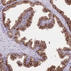 Immunohistochemical staining of human prostate shows strong cytoplasmic granular positivity in glandular cells.