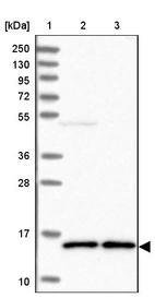 Lane 1: Marker [kDa] 250, 130, 95, 72, 55, 36, 28, 17, 10_br/_Lane 2: Human cell line RT-4_br/_Lane 3: Human cell line U-251MG sp