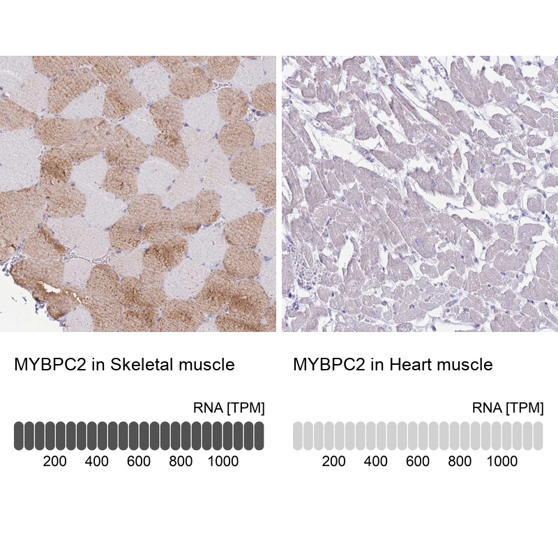 Anti-MYBPC2 Antibody