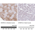 Anti-MYBPC2 Antibody