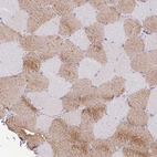 Immunohistochemical staining of human skeletal muscle shows high expression.