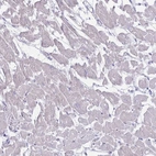 Immunohistochemical staining of human heart muscle shows low expression as expected.