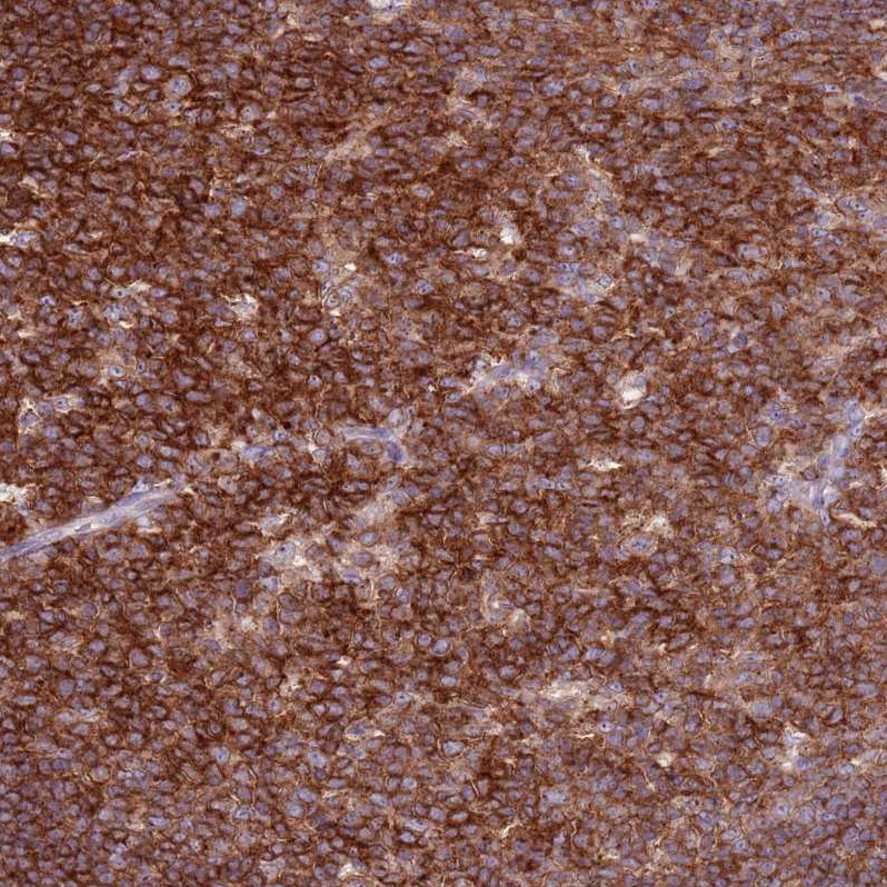 Anti-ZSWIM1 Antibody