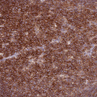 Anti-ZSWIM1 Antibody