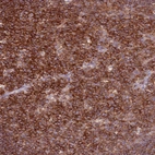 Anti-ZSWIM1 Antibody