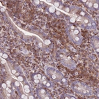 Immunohistochemical staining of human duodenum shows moderate cytoplasmic positivity in lymphoid cells.